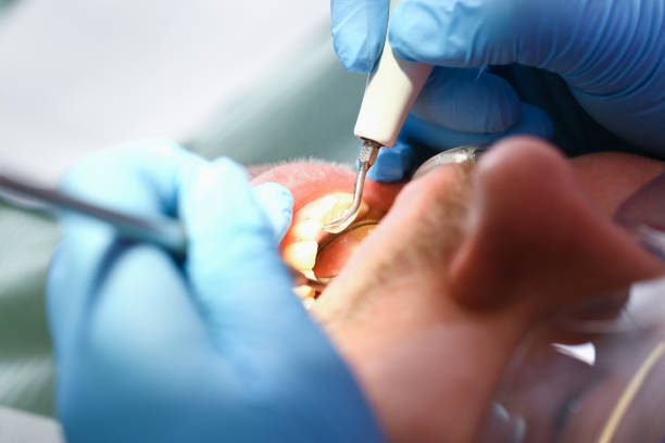 Best Mobile Emergency Dentist in Gholson, TX