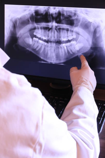 Best Emergency Dental Care for Abscessed Tooth in Gholson, TX