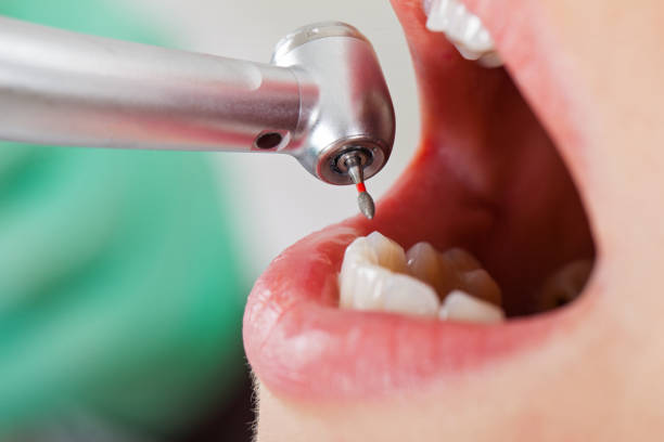 Best Broken or Cracked Tooth Emergency Dentist in Gholson, TX